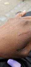 woolly aphid (subfamily Eriosomatinae) 09