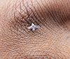 woolly aphid (subfamily Eriosomatinae)